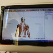 EMG-Bildschirm mit pathologischem Trapezius-Befund in der Orthopädie am St. Lambertiplatz.