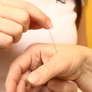 Foto einer Hand, die eine Akupunkturnadel bei Dickdarm 4 setzt.